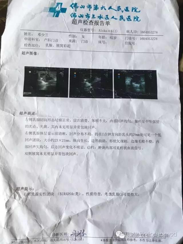 原始点调理乳腺癌四十多天恢复健康，63岁阿姨每天可做300个起俯运动