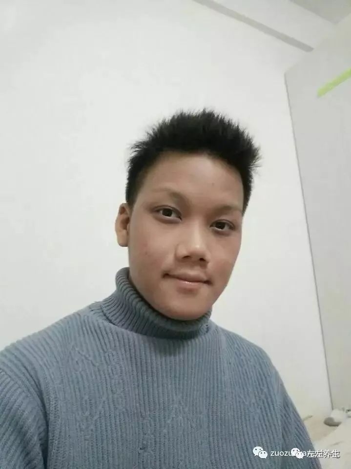 案例分享:马来西亚男孩严重湿疹、十天后大变样 案例分享:马来西亚男孩严重湿疹、十天后大变样