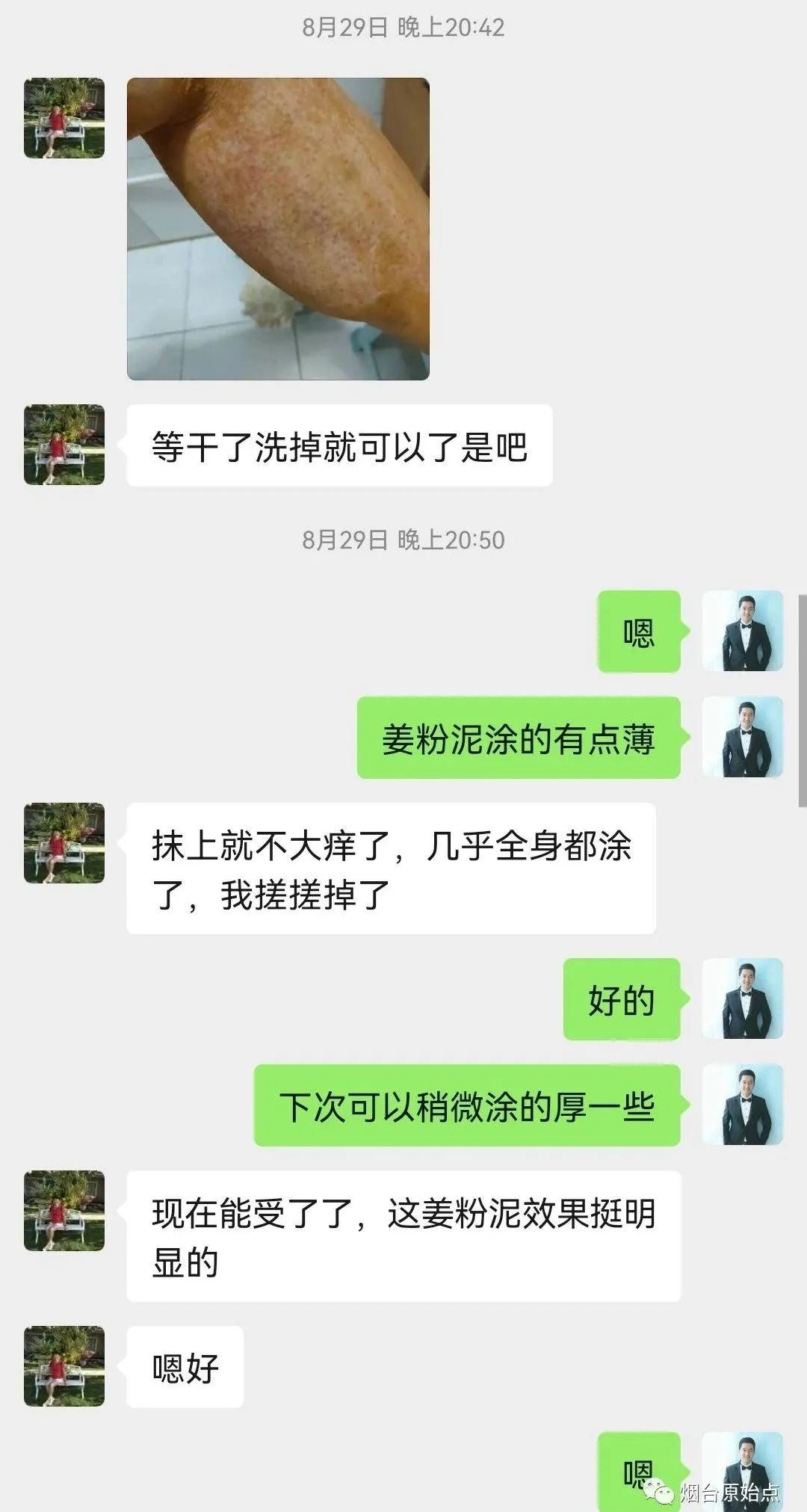 术后药物引起皮肤过敏案例